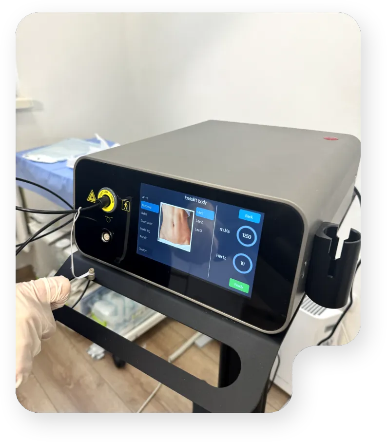 Технічні характеристики приладу ENDOLIFT LASEMAR® 1500